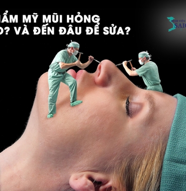 THẨM MỸ MŨI HỎNG, TẠI SAO? VÀ ĐẾN ĐÂU ĐỂ SỬA