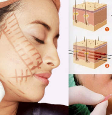 GIỮ GÌN DA TƯƠI TRẺ BẰNG PHƯƠNG PHÁP THẨM MỸ