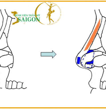 KHIẾM KHUYẾT GÌ Ở SẮC ĐẸP CỦA BẠN?