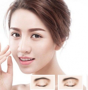 Những mẹo nhỏ làm hết thâm bầm mắt sau khi cắt mí mắt và nhấn mí mắt