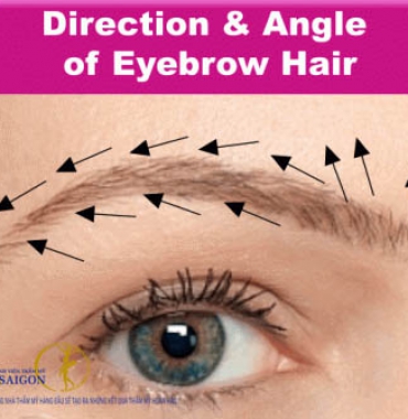 Cấy lông mày tự thân đúng chiều hướng không bị lệch