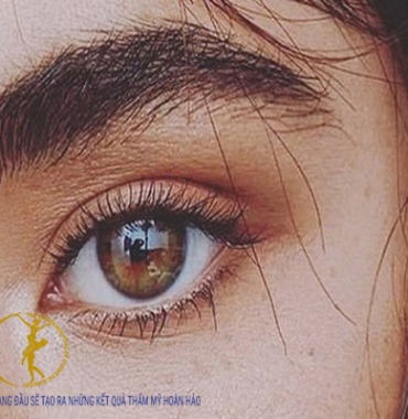 Lông mày mọc ngược thì chỉnh sửa thẩm mỹ ở đâu