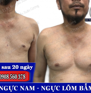 Thẩm mỹ viện chuyên nâng ngực nam bị lép và cải thiện hình dạng ngực cho nam
