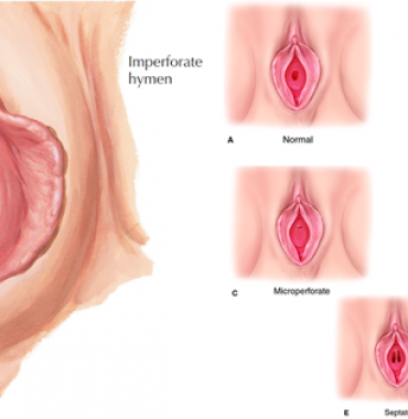 Tìm địa chỉ thẩm mỹ vá màng trinh với bác sĩ nhiều năm kinh nghiệm tại TPHCM