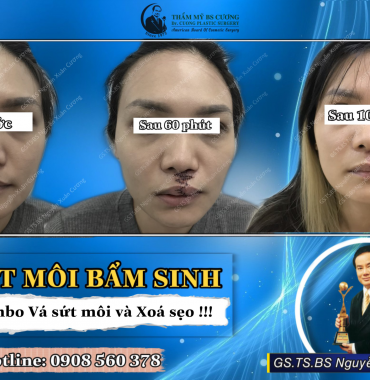 Tìm bác sĩ xóa sẹo sức môi nhanh lành và không để lại sẹo